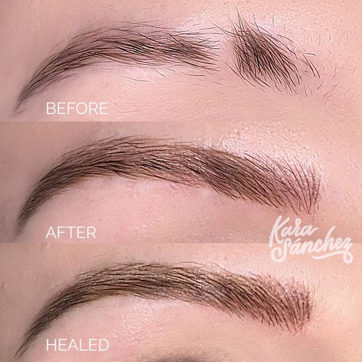 Microblading Before and After : Scar Correction - InspiringPeople ...