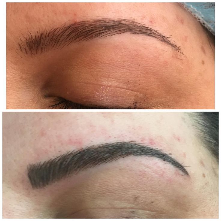 Microblading Before and After : Microblading before and after touch up ...